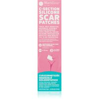 MomCare by Lina C-Section Silicone Scar Patches silikónové náplasti na jazvy po cisárskom reze veľkosť S-M 3x15 cm 3 ks