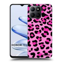 ULTIMATE CASE pro Honor 70 Lite - Pink Tiger