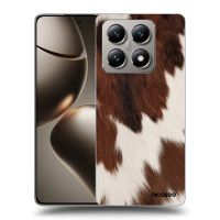 Silikónový čierny obal pre Xiaomi 14T - Rustica