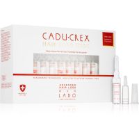 CADU-CREX Hair Loss HSSC Advanced Hair Loss сироватка для волосся для чоловіків проти прогресуючого випадіння волосся для чоловіків 20x3,5 мл