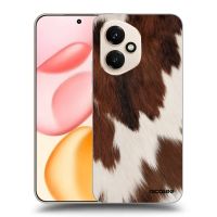 Silikónový prehľadný obal pre Honor 400 5G - Rustica