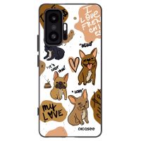 Silikónový čierny obal pre Xiaomi 11T - Frenchies