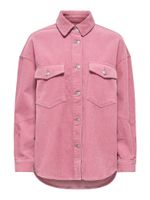 ONLY Bluza 'ONLTiggy'  svijetloroza