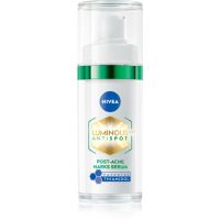 NIVEA Luminous Serum gegen Pigmentflecken 30 ml