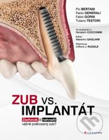 Zub vs. implantát - Pio Bertani, Paolo Generali, Fabio Gorni, Tiziano Testori - kniha z kategorie Medicína